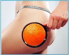 Вебинар Ad Medicine: «Козни варикоза, груз лимфостаза и «апельсиновая корка»